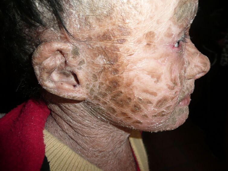 Stefan aus Deutschland hilft der kleinen Cinthia