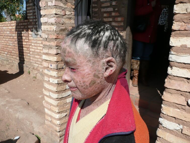 Stefan aus Deutschland hilft der kleinen Cinthia