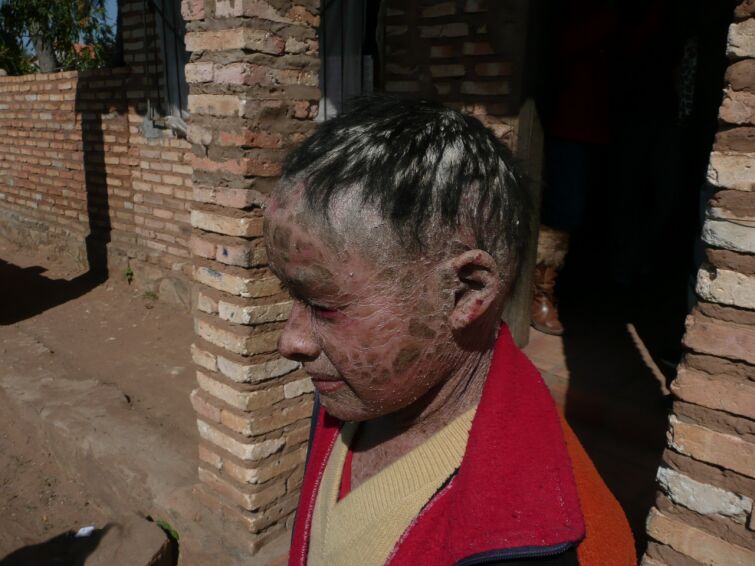 Stefan aus Deutschland hilft der kleinen Cinthia