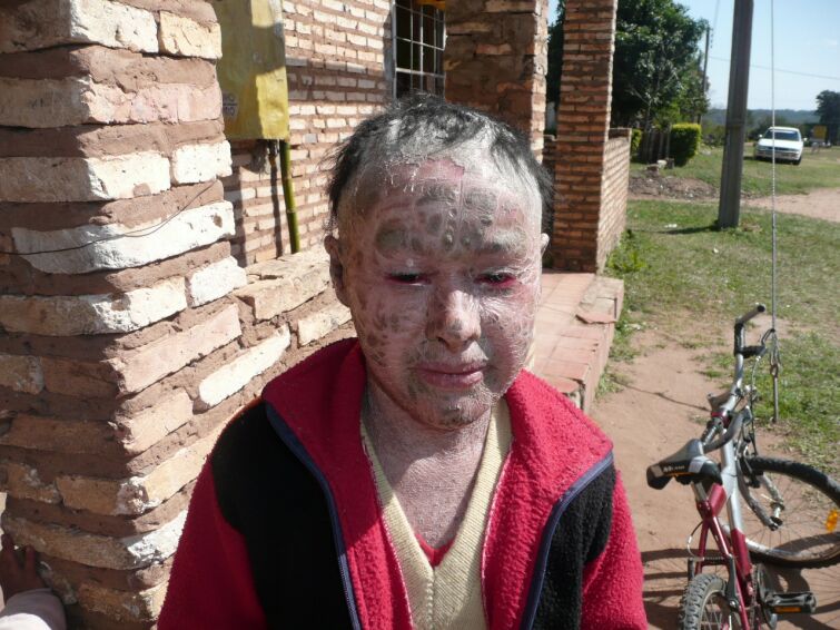 Stefan aus Deutschland hilft der kleinen Cinthia