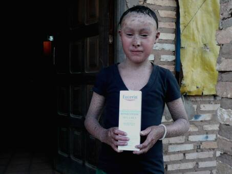  Firma Beiersdorf hilft  Cinthia mit Eucerin