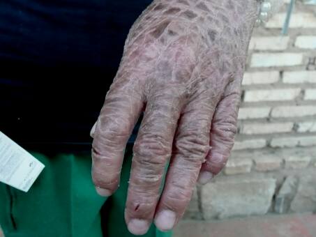  Firma Beiersdorf hilft  Cinthia mit Eucerin