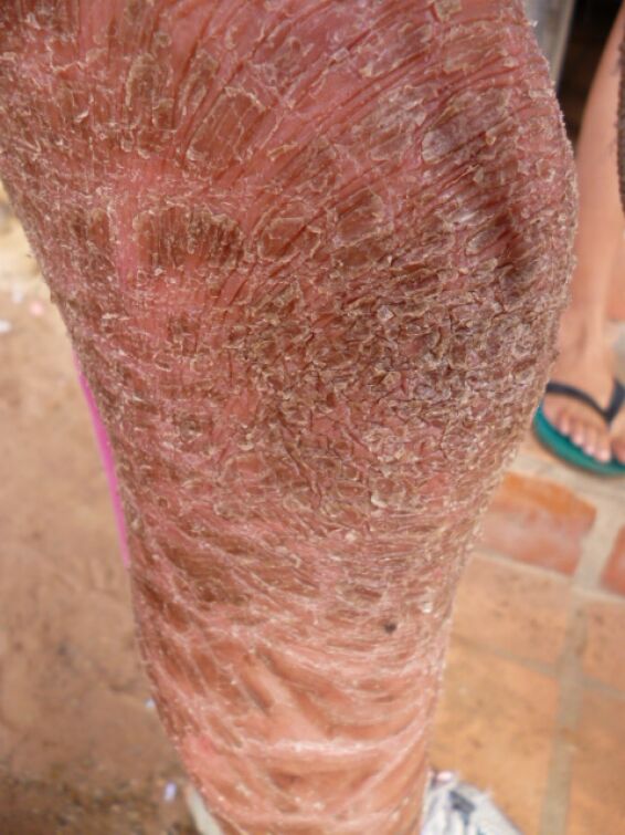 Anke, Ralf aus Hamburg und Beiersdorf